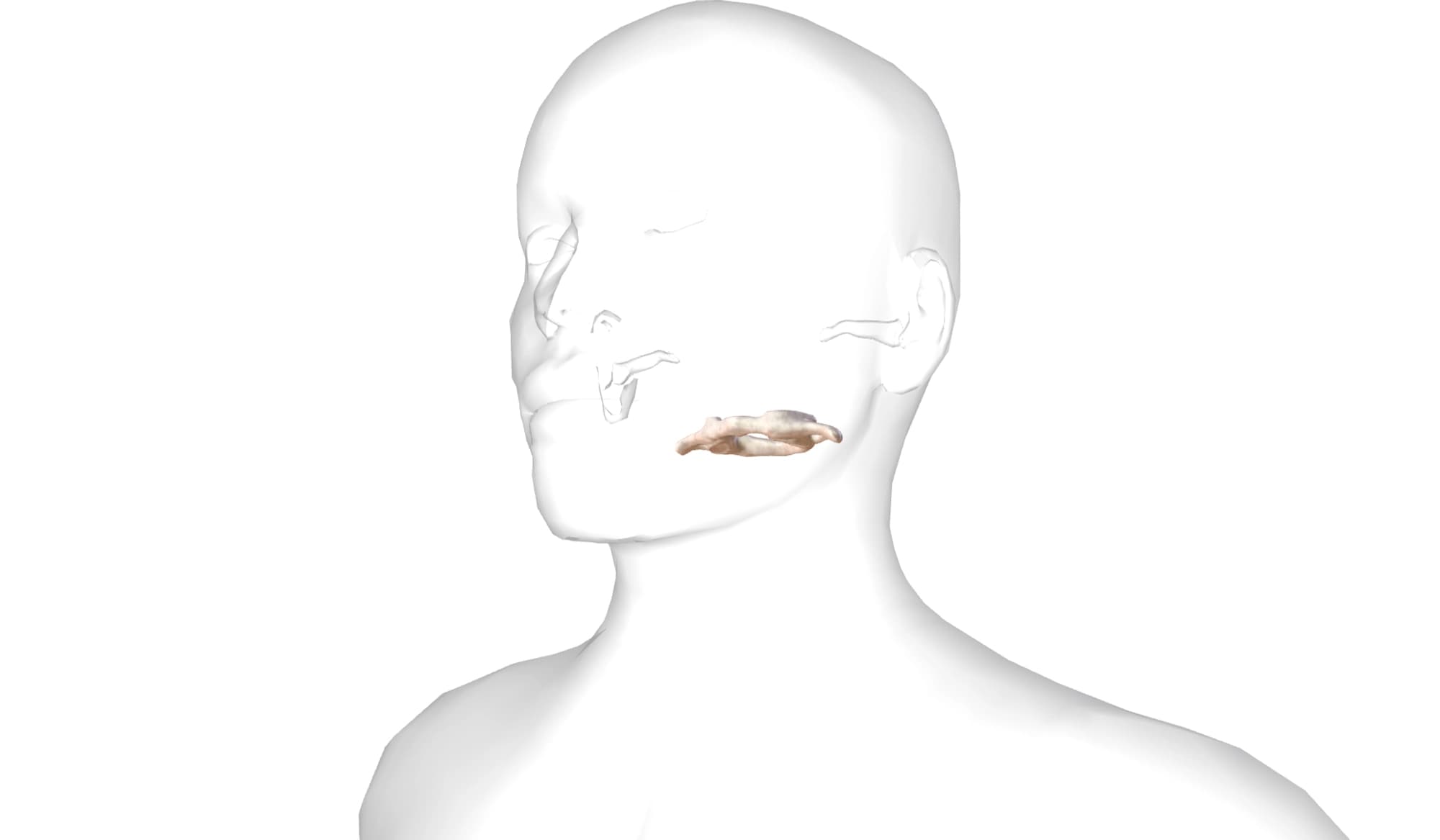 Disallineamento Atlante Cause e Conseguenze