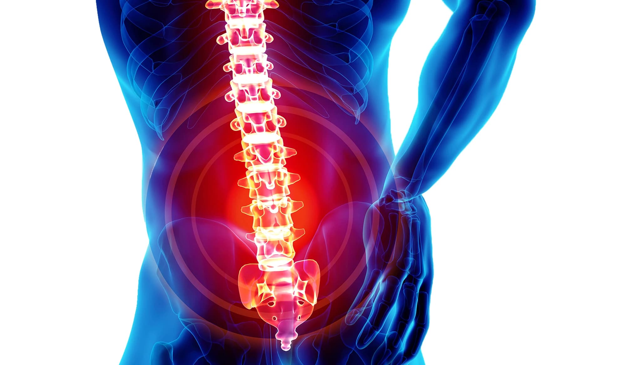 Lombalgia intervento GP